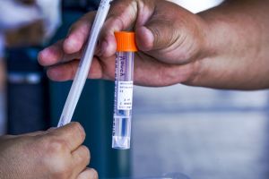 View of a hand handling a testing tube to get a swab sample...