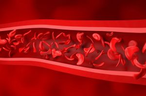 Sickle cell anaemia - isometric view 3d illustration